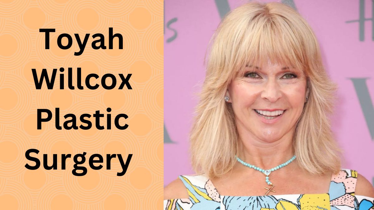 Toyah Willcox Plastic Surgery