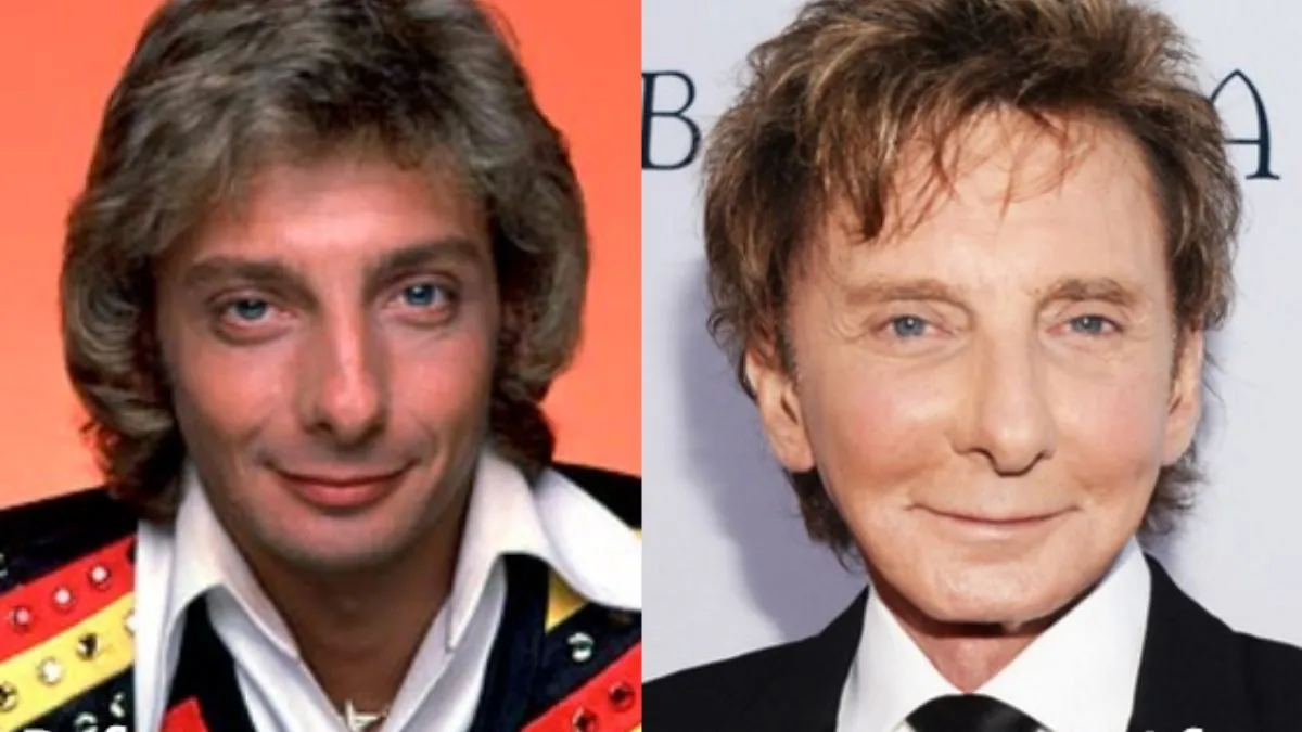 Barry Manilow Before And After