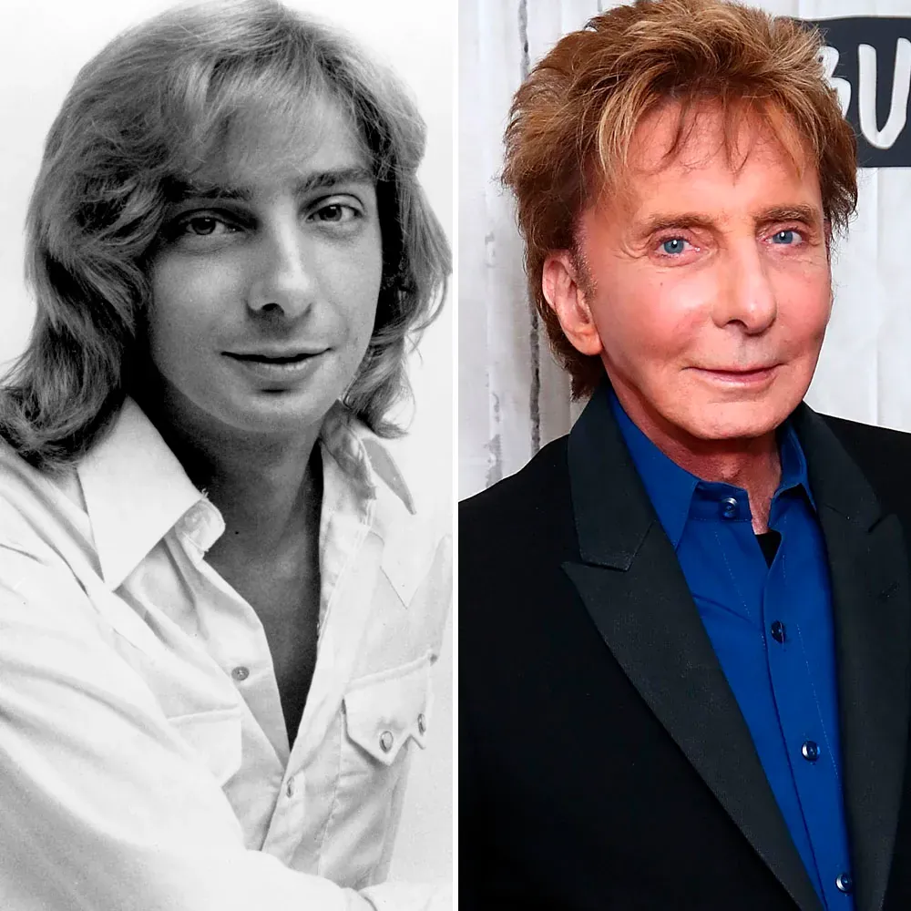 Barry Manilow Before And After